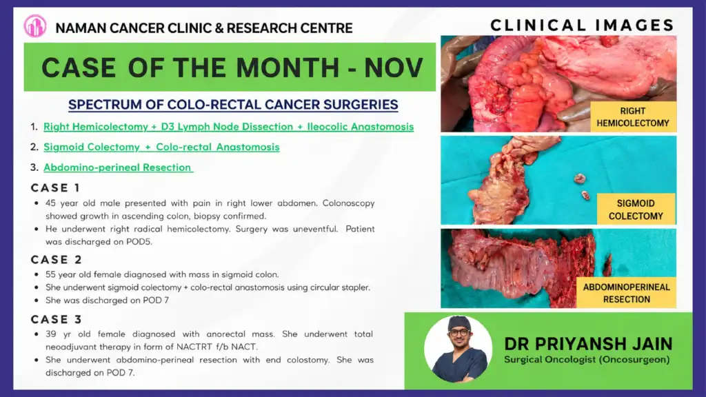 Advanced Colorectal Cancer Surgery by Dr Priyansh Jain in Surat