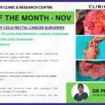 Advanced Colorectal Cancer Surgery by Dr Priyansh Jain in Surat