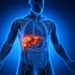 Liver Metastasis: Causes, Symptoms, Diagnosis and Treatment Options